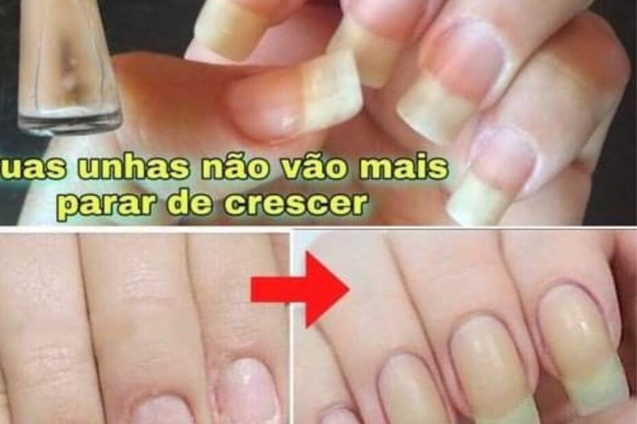 receita para unhas crescerem