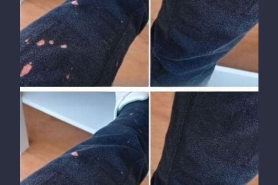 como tirar as manchas de água sanitária ou alvejante das roupas