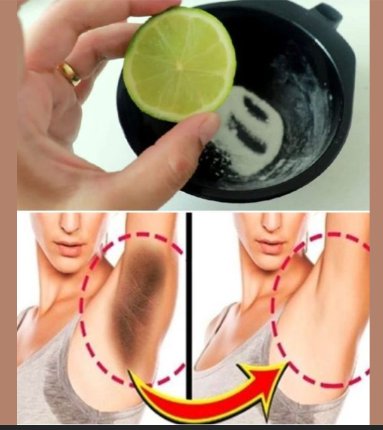 Receita para clarear axila e virilha em 5 minutos.